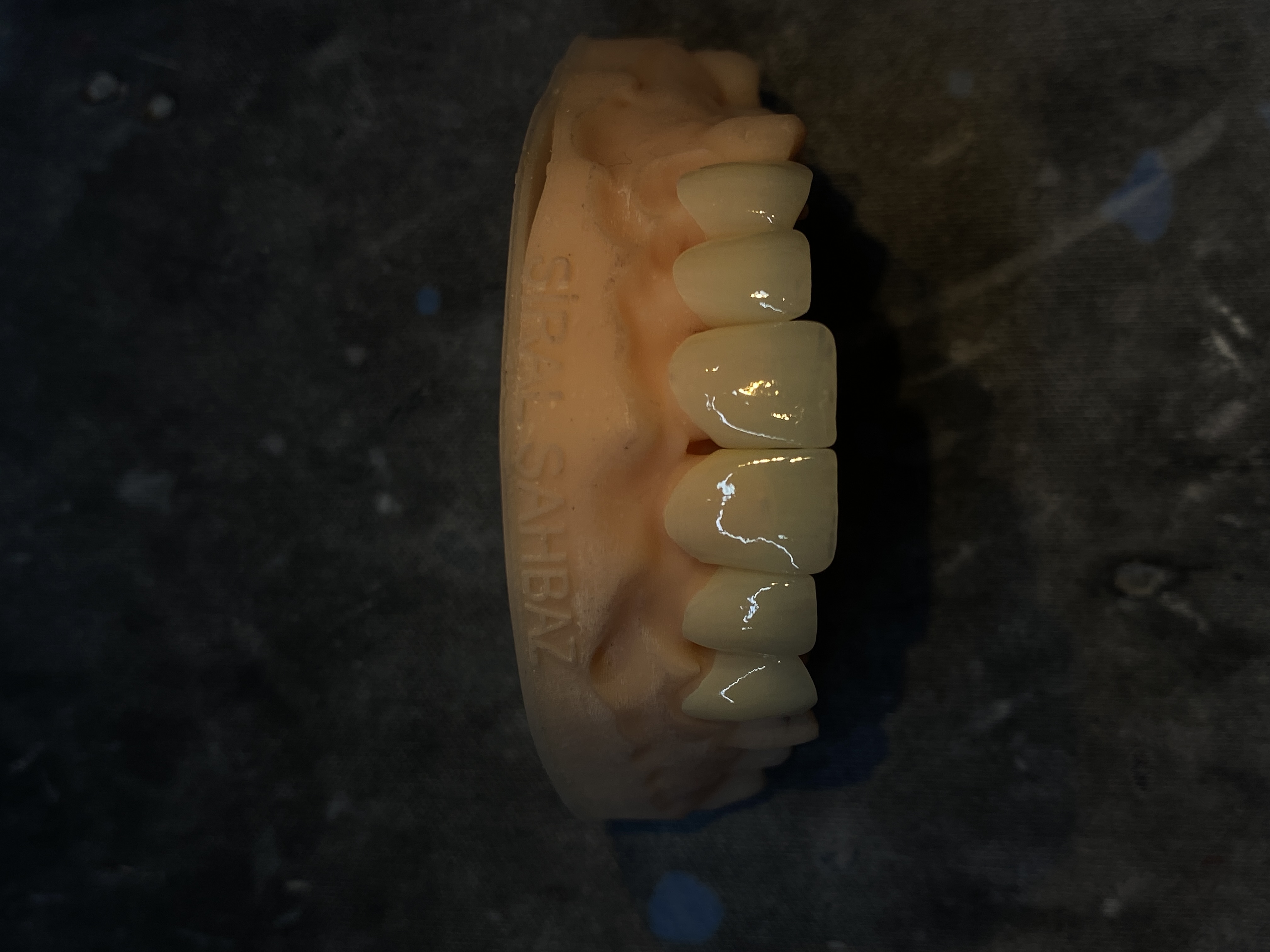 Emax